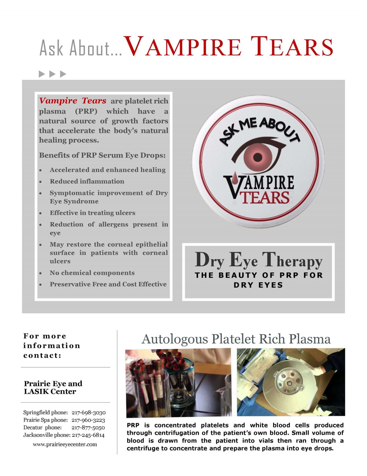 Dry Eye Prairie Eye Center